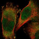 RNF25 Polyclonal Antibody