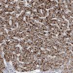 RNF25 Antibody in Immunohistochemistry (Paraffin) (IHC (P))