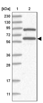 RNF25 Antibody in Western Blot (WB)