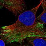 RNF25 Polyclonal Antibody