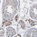 RNF25 Antibody in Immunohistochemistry (Paraffin) (IHC (P))