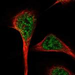 RBM27 Polyclonal Antibody