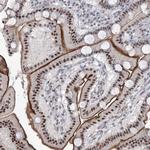 RBM27 Antibody in Immunohistochemistry (Paraffin) (IHC (P))