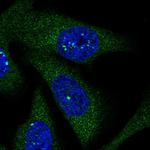LARS Polyclonal Antibody