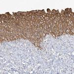 LARS Antibody in Immunohistochemistry (IHC)