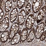 PCBD2 Antibody in Immunohistochemistry (IHC)