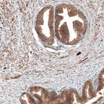DMXL1 Antibody in Immunohistochemistry (IHC)