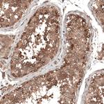 DMXL1 Antibody in Immunohistochemistry (IHC)