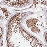 DMXL1 Antibody in Immunohistochemistry (Paraffin) (IHC (P))