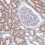 DMGDH Polyclonal Antibody