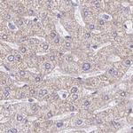 DMGDH Antibody in Immunohistochemistry (IHC)