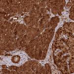 ABHEB Antibody in Immunohistochemistry (Paraffin) (IHC (P))