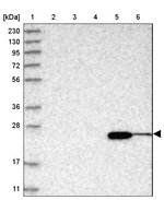 ABHEB Antibody in Western Blot (WB)