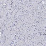 SAB Antibody in Immunohistochemistry (Paraffin) (IHC (P))