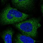 SPAT5 Polyclonal Antibody