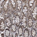 SPAT5 Antibody in Immunohistochemistry (Paraffin) (IHC (P))