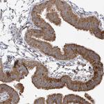 SPAT5 Antibody in Immunohistochemistry (Paraffin) (IHC (P))