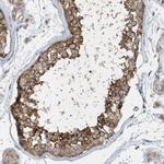 SPAT5 Antibody in Immunohistochemistry (Paraffin) (IHC (P))