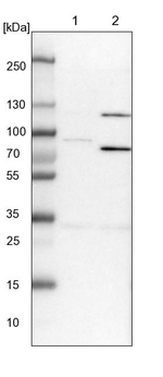 SPAT5 Antibody in Western Blot (WB)