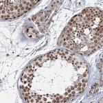 FAM53A Antibody in Immunohistochemistry (IHC)