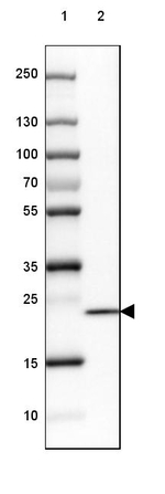 SPINK13 Antibody in Western Blot (WB)