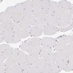 DOCK2 Antibody in Immunohistochemistry (Paraffin) (IHC (P))