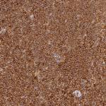 DOCK2 Polyclonal Antibody