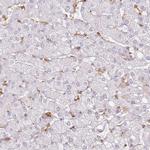 DOCK2 Antibody in Immunohistochemistry (IHC)