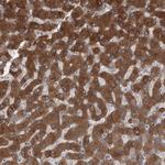 AASDH Polyclonal Antibody