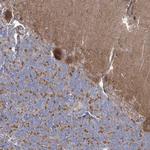 ARSJ Antibody in Immunohistochemistry (Paraffin) (IHC (P))