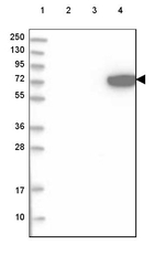 ARSJ Antibody in Western Blot (WB)