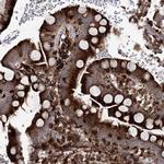 DCUN1D4 Antibody in Immunohistochemistry (Paraffin) (IHC (P))