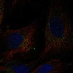 DCUN1D4 Polyclonal Antibody