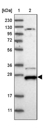 DCUN1D4 Antibody in Western Blot (WB)