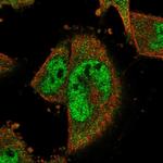 COPS8 Polyclonal Antibody