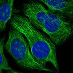 TBCA Polyclonal Antibody