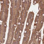 TBCA Antibody in Immunohistochemistry (Paraffin) (IHC (P))