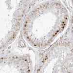 DMRTB1 Antibody in Immunohistochemistry (IHC)