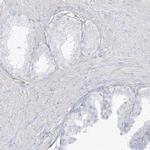 DMRTB1 Antibody in Immunohistochemistry (IHC)