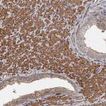 DHRS9 Polyclonal Antibody