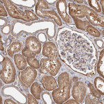 DHRS9 Antibody in Immunohistochemistry (Paraffin) (IHC (P))