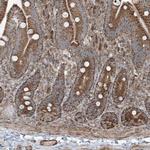 KY Antibody in Immunohistochemistry (Paraffin) (IHC (P))