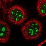 CENPH Antibody in Immunocytochemistry (ICC/IF)