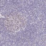 CENPH Antibody in Immunohistochemistry (IHC)