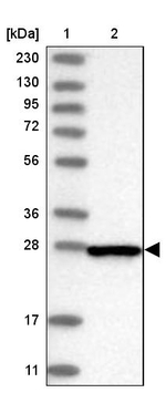 CENPH Antibody in Western Blot (WB)