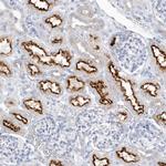 Ribulose-phosphate 3-epimerase Polyclonal Antibody