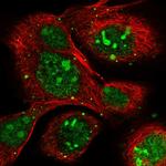 NOP16 Polyclonal Antibody