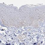 NOP16 Antibody in Immunohistochemistry (Paraffin) (IHC (P))