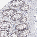 NOP16 Antibody in Immunohistochemistry (Paraffin) (IHC (P))