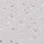 NOP16 Antibody in Immunohistochemistry (Paraffin) (IHC (P))